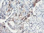 SERPINB2 Antibody in Immunohistochemistry (Paraffin) (IHC (P))