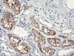 SERPINB2 Antibody in Immunohistochemistry (Paraffin) (IHC (P))