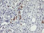 SERPINB2 Antibody in Immunohistochemistry (Paraffin) (IHC (P))