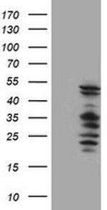 SERPINB2 Antibody in Western Blot (WB)