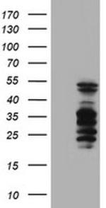 SERPINB2 Antibody in Western Blot (WB)