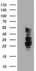 SERPINB2 Antibody in Western Blot (WB)