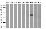 SERPINB2 Antibody in Western Blot (WB)