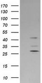 SERPINB2 Antibody in Western Blot (WB)