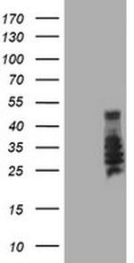 SERPINB2 Antibody in Western Blot (WB)