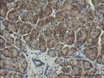 SERPINB3 Antibody in Immunohistochemistry (Paraffin) (IHC (P))