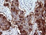 SERPINB3 Antibody in Immunohistochemistry (Paraffin) (IHC (P))