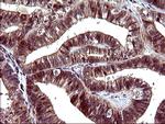 SERPINB3 Antibody in Immunohistochemistry (Paraffin) (IHC (P))