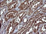 SERPINB3 Antibody in Immunohistochemistry (Paraffin) (IHC (P))