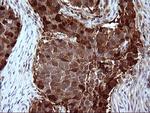 SERPINB3 Antibody in Immunohistochemistry (Paraffin) (IHC (P))