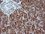 SERPINB3 Antibody in Immunohistochemistry (Paraffin) (IHC (P))