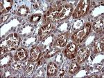 SERPINB3 Antibody in Immunohistochemistry (Paraffin) (IHC (P))