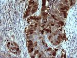 SERPINB3 Antibody in Immunohistochemistry (Paraffin) (IHC (P))