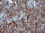 SERPINB3 Antibody in Immunohistochemistry (Paraffin) (IHC (P))