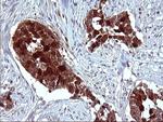 SERPINB3 Antibody in Immunohistochemistry (Paraffin) (IHC (P))