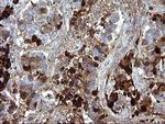 SERPINB3 Antibody in Immunohistochemistry (Paraffin) (IHC (P))