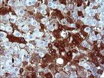 SERPINB3 Antibody in Immunohistochemistry (Paraffin) (IHC (P))