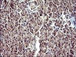 SERPINB3 Antibody in Immunohistochemistry (Paraffin) (IHC (P))