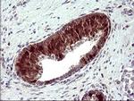 SERPINB3 Antibody in Immunohistochemistry (Paraffin) (IHC (P))