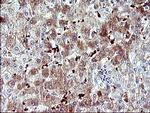 SERPINB3 Antibody in Immunohistochemistry (Paraffin) (IHC (P))