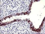 SERPINB3 Antibody in Immunohistochemistry (Paraffin) (IHC (P))