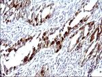 SERPINB3 Antibody in Immunohistochemistry (Paraffin) (IHC (P))