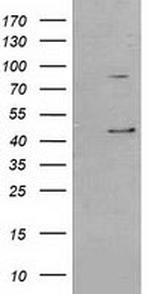 SERPINB3 Antibody in Western Blot (WB)