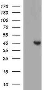 SERPINB3 Antibody in Western Blot (WB)