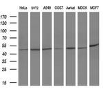 SERPINB3 Antibody in Western Blot (WB)