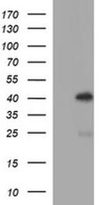 SERPINB3 Antibody in Western Blot (WB)