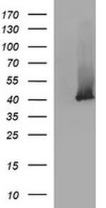 SERPINB3 Antibody in Western Blot (WB)