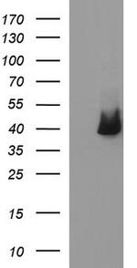 SERPINB3 Antibody in Western Blot (WB)