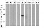 SERPINB3 Antibody in Western Blot (WB)