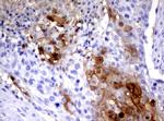 SERPINB4 Antibody in Immunohistochemistry (Paraffin) (IHC (P))