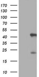 SERPINB6 Antibody in Western Blot (WB)