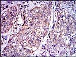 PAI1 Antibody in Immunohistochemistry (Paraffin) (IHC (P))