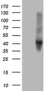 SERPINE2 Antibody in Western Blot (WB)