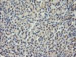 SESTD1 Antibody in Immunohistochemistry (Paraffin) (IHC (P))