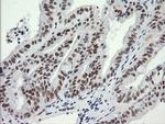 SESTD1 Antibody in Immunohistochemistry (Paraffin) (IHC (P))