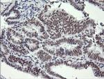 SESTD1 Antibody in Immunohistochemistry (Paraffin) (IHC (P))