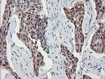 SESTD1 Antibody in Immunohistochemistry (Paraffin) (IHC (P))