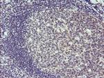 SESTD1 Antibody in Immunohistochemistry (Paraffin) (IHC (P))