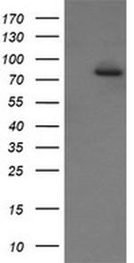 SESTD1 Antibody in Western Blot (WB)