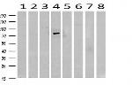 SESTD1 Antibody in Western Blot (WB)