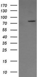 SESTD1 Antibody in Western Blot (WB)