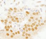 SET7 Antibody in Immunohistochemistry (IHC)