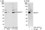 SET7 Antibody in Western Blot (WB)