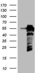 SETD2 Antibody in Western Blot (WB)