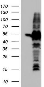 SETD2 Antibody in Western Blot (WB)