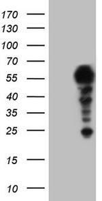 SETD2 Antibody in Western Blot (WB)